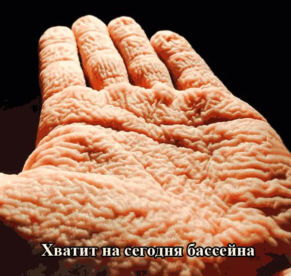 Пример мацерации Ладонь человека после длительного пребывания в воде (мацерация)
